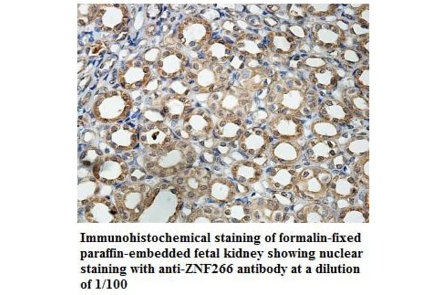 ZNF266 Antibody from Signalway Antibody (39882) - Antibodies.com