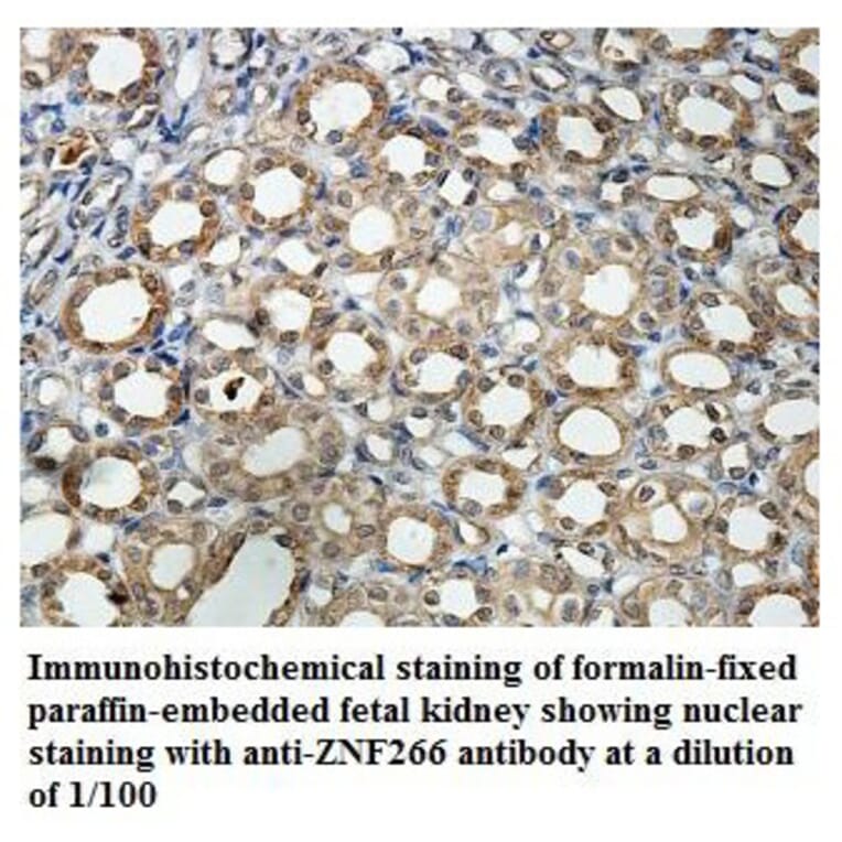 ZNF266 Antibody from Signalway Antibody (39882) - Antibodies.com