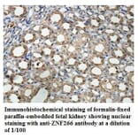 ZNF266 Antibody from Signalway Antibody (39882) - Antibodies.com