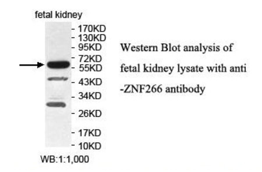 ZNF266 Antibody from Signalway Antibody (39882) - Antibodies.com