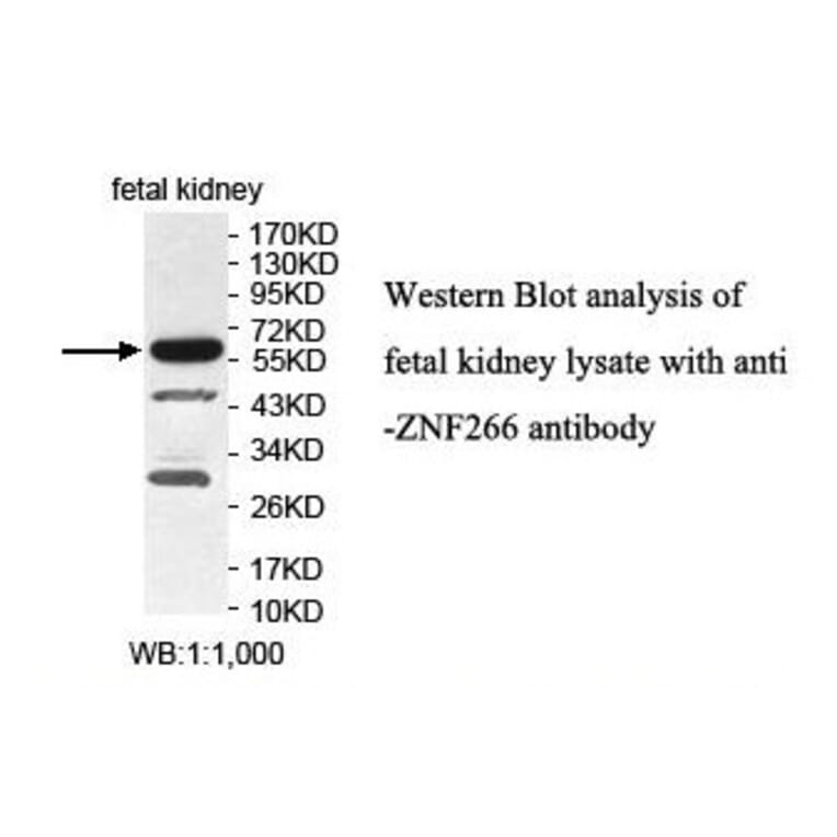 ZNF266 Antibody from Signalway Antibody (39882) - Antibodies.com