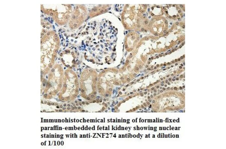 ZNF274 Antibody from Signalway Antibody (39883) - Antibodies.com