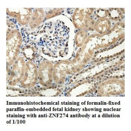 ZNF274 Antibody from Signalway Antibody (39883) - Antibodies.com