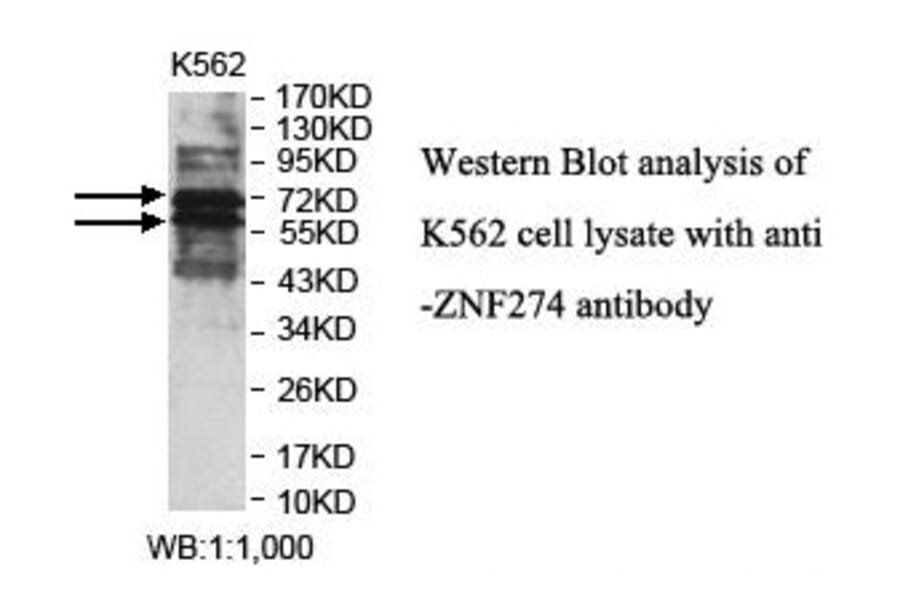 ZNF274 Antibody from Signalway Antibody (39883) - Antibodies.com