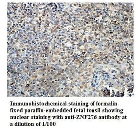 ZNF276 Antibody from Signalway Antibody (39884) - Antibodies.com