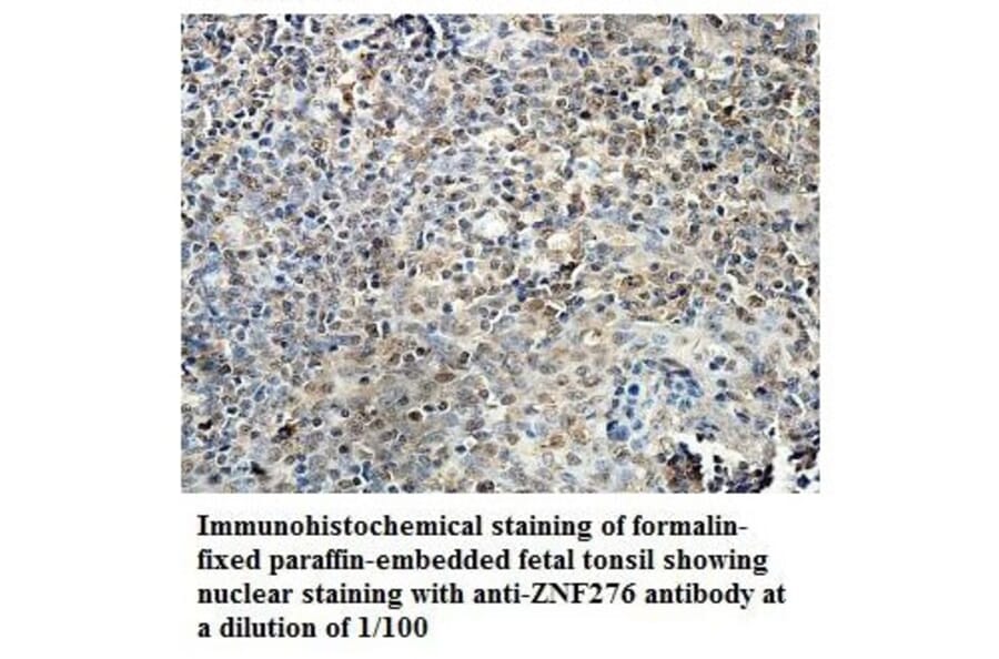 ZNF276 Antibody from Signalway Antibody (39884) - Antibodies.com