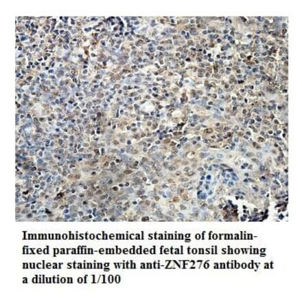 ZNF276 Antibody from Signalway Antibody (39884) - Antibodies.com