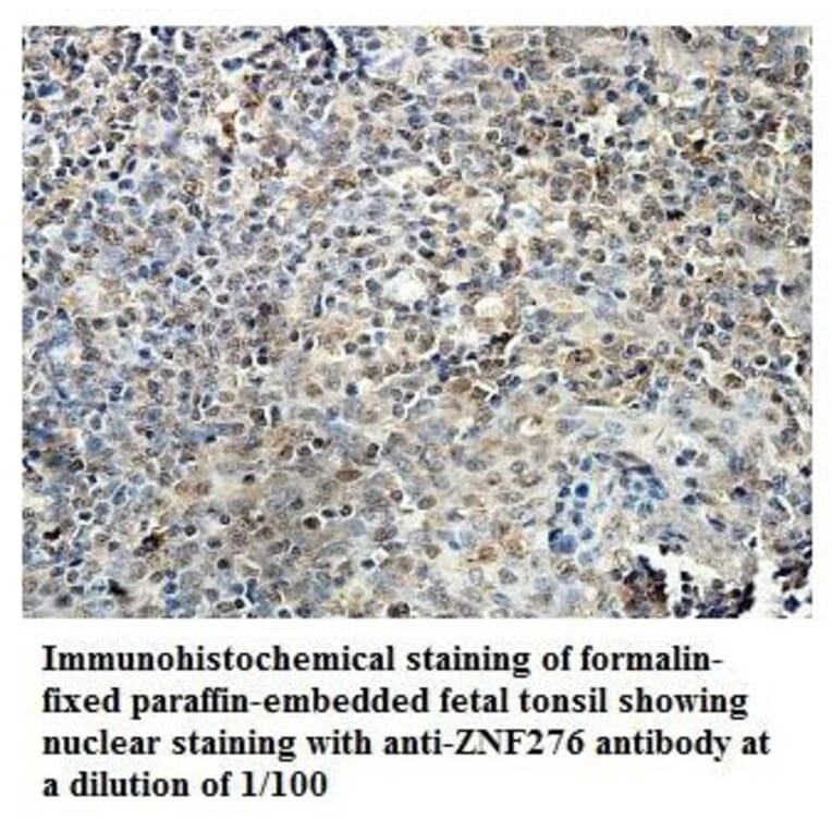 ZNF276 Antibody from Signalway Antibody (39884) - Antibodies.com