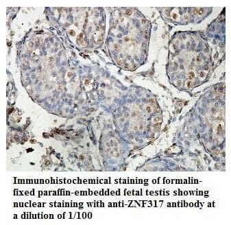 Anti-ZNF317 Antibody