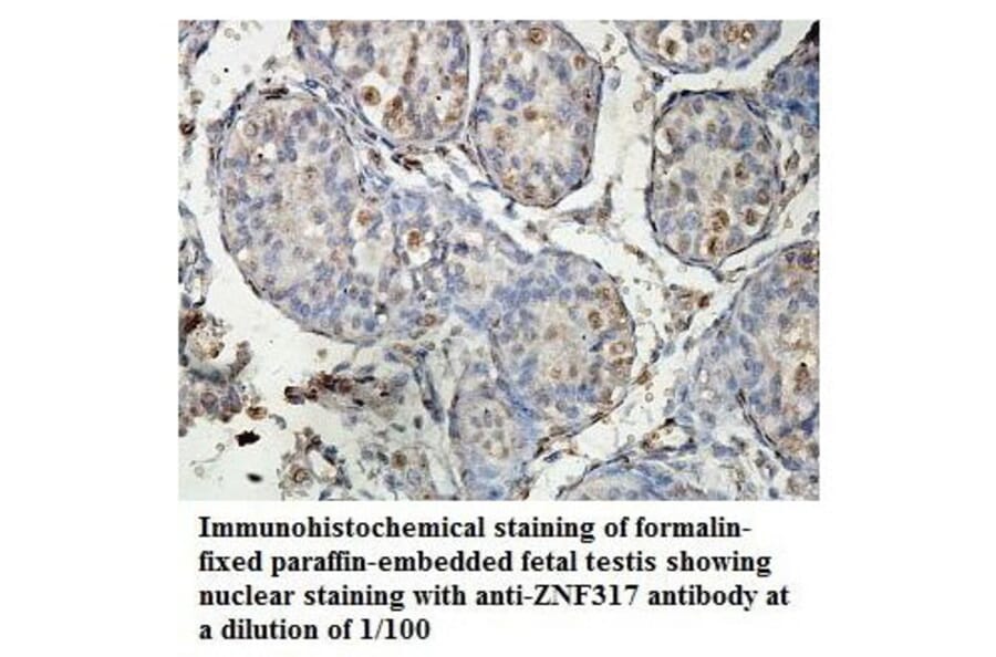 ZNF317 Antibody from Signalway Antibody (39885) - Antibodies.com