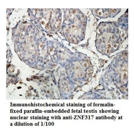 ZNF317 Antibody from Signalway Antibody (39885) - Antibodies.com