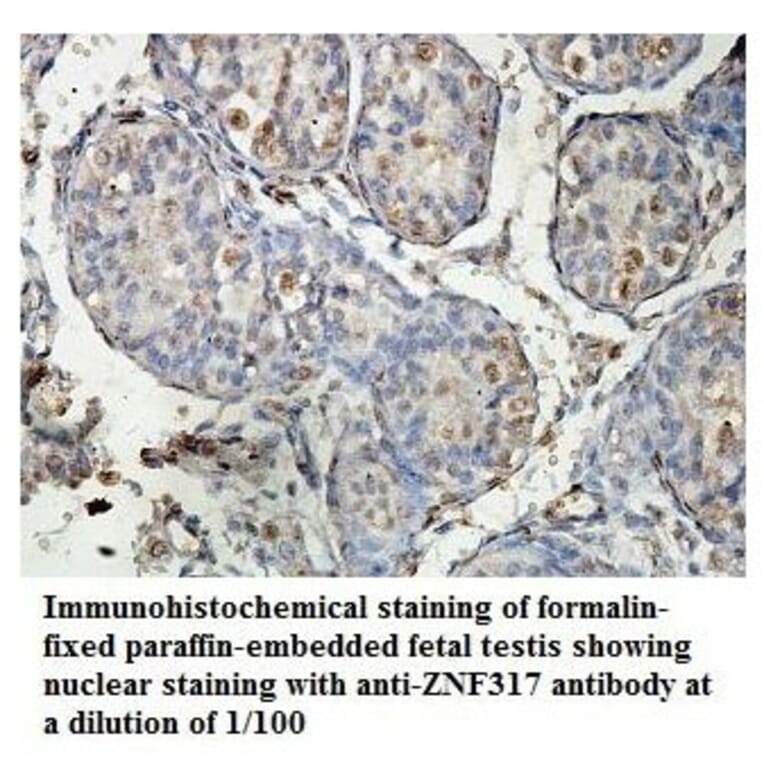 ZNF317 Antibody from Signalway Antibody (39885) - Antibodies.com