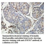 ZNF317 Antibody from Signalway Antibody (39885) - Antibodies.com