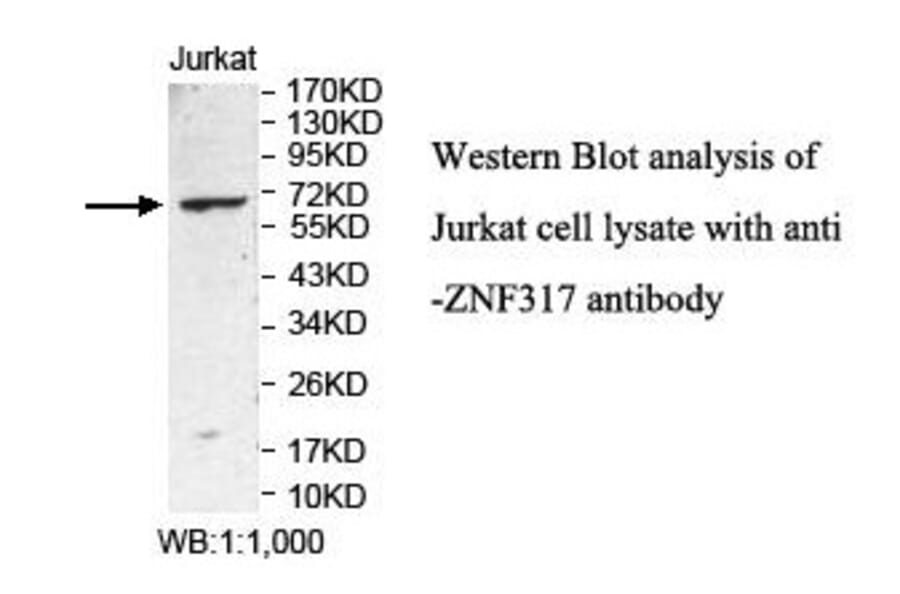 ZNF317 Antibody from Signalway Antibody (39885) - Antibodies.com