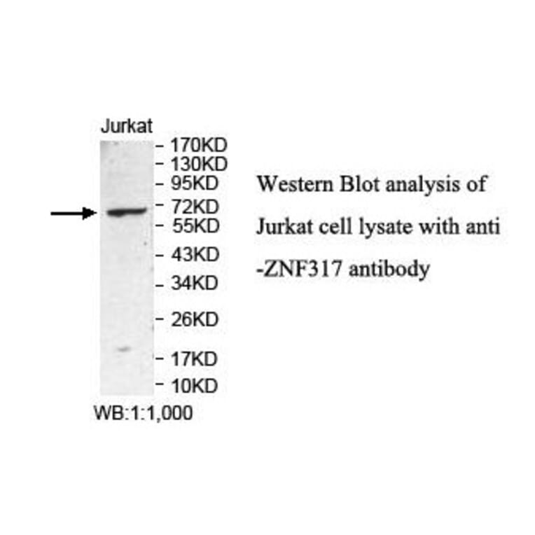 ZNF317 Antibody from Signalway Antibody (39885) - Antibodies.com