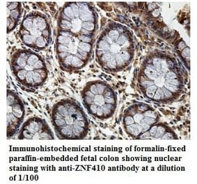 ZNF410 Antibody from Signalway Antibody (39886) - Antibodies.com