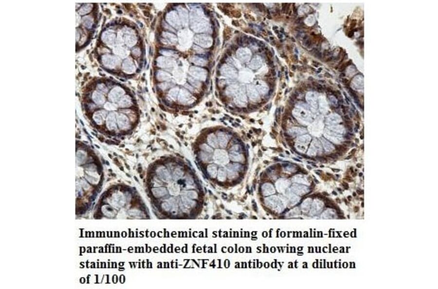 ZNF410 Antibody from Signalway Antibody (39886) - Antibodies.com