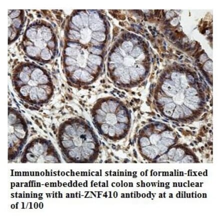 ZNF410 Antibody from Signalway Antibody (39886) - Antibodies.com
