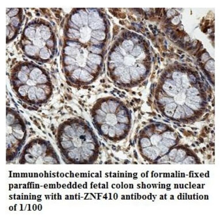 ZNF410 Antibody from Signalway Antibody (39886) - Antibodies.com
