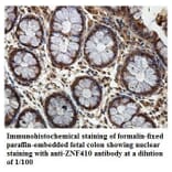ZNF410 Antibody from Signalway Antibody (39886) - Antibodies.com