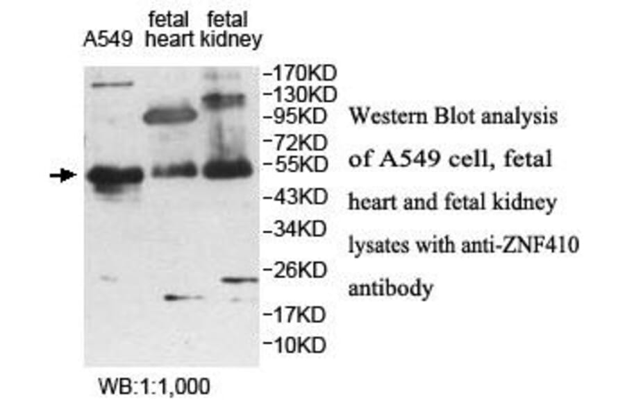 ZNF410 Antibody from Signalway Antibody (39886) - Antibodies.com