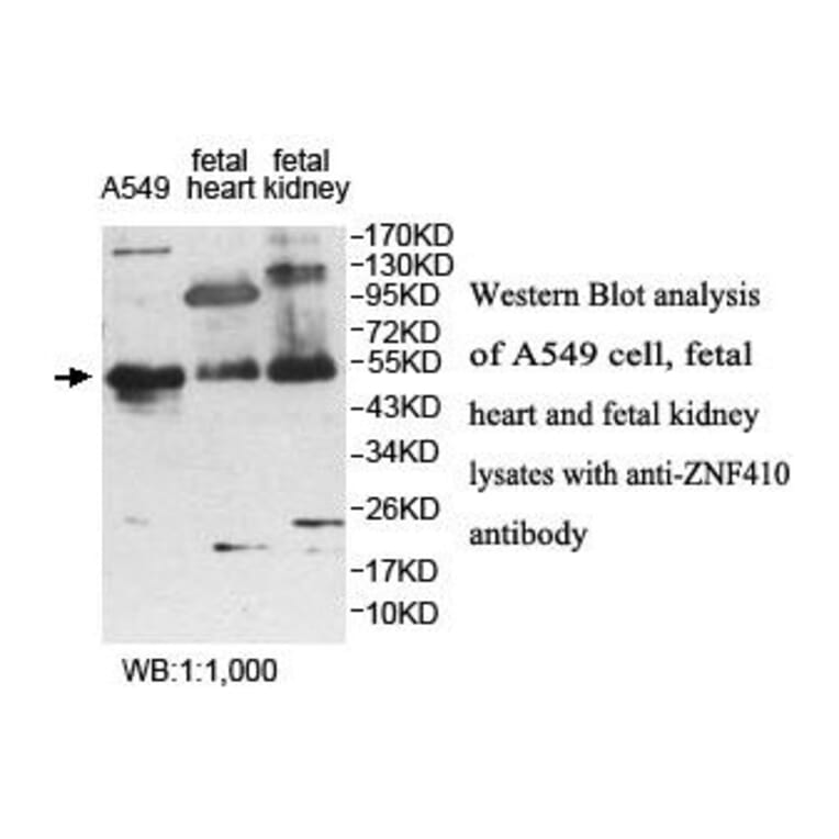 ZNF410 Antibody from Signalway Antibody (39886) - Antibodies.com