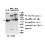 ZNF410 Antibody from Signalway Antibody (39886) - Antibodies.com
