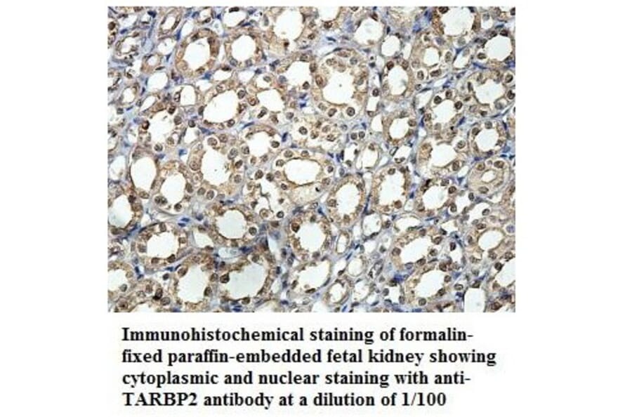 TARBP2 Antibody from Signalway Antibody (39889) - Antibodies.com