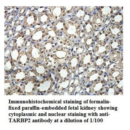 TARBP2 Antibody from Signalway Antibody (39889) - Antibodies.com
