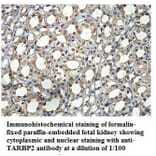 TARBP2 Antibody from Signalway Antibody (39889) - Antibodies.com