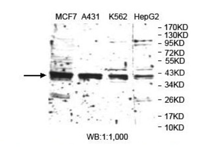 TARBP2 Antibody from Signalway Antibody (39889) - Antibodies.com