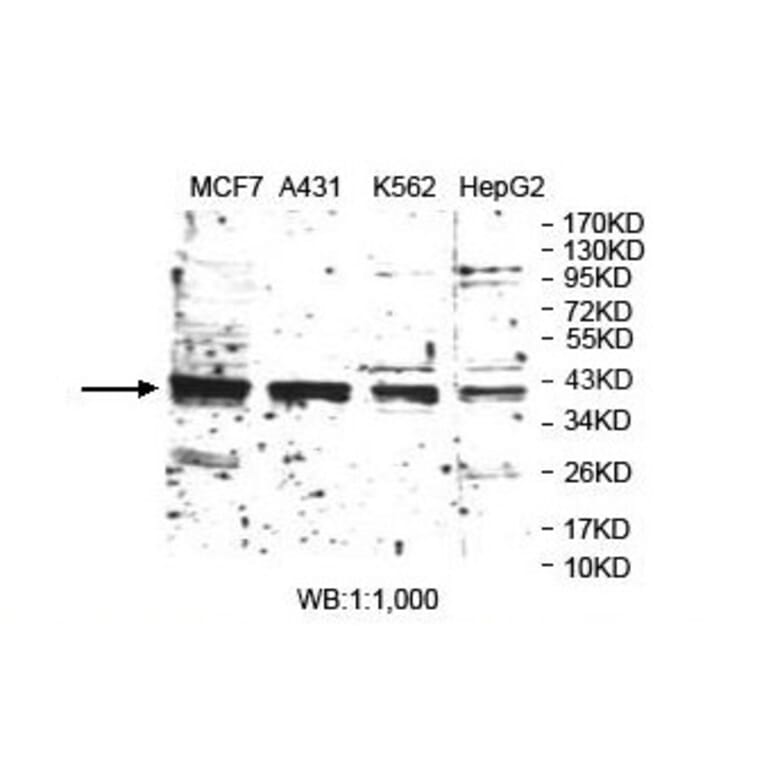 TARBP2 Antibody from Signalway Antibody (39889) - Antibodies.com