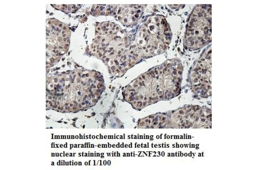 ZNF230 Antibody from Signalway Antibody (39890) - Antibodies.com