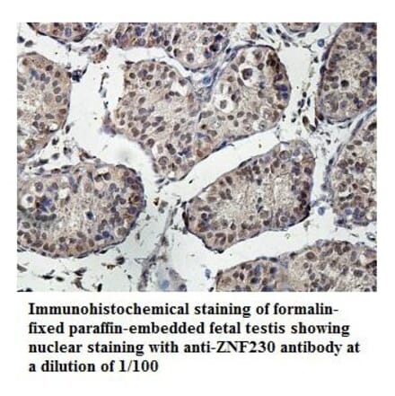 ZNF230 Antibody from Signalway Antibody (39890) - Antibodies.com