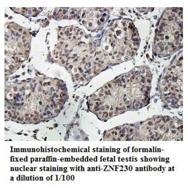 ZNF230 Antibody from Signalway Antibody (39890) - Antibodies.com