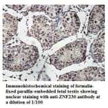 ZNF230 Antibody from Signalway Antibody (39890) - Antibodies.com