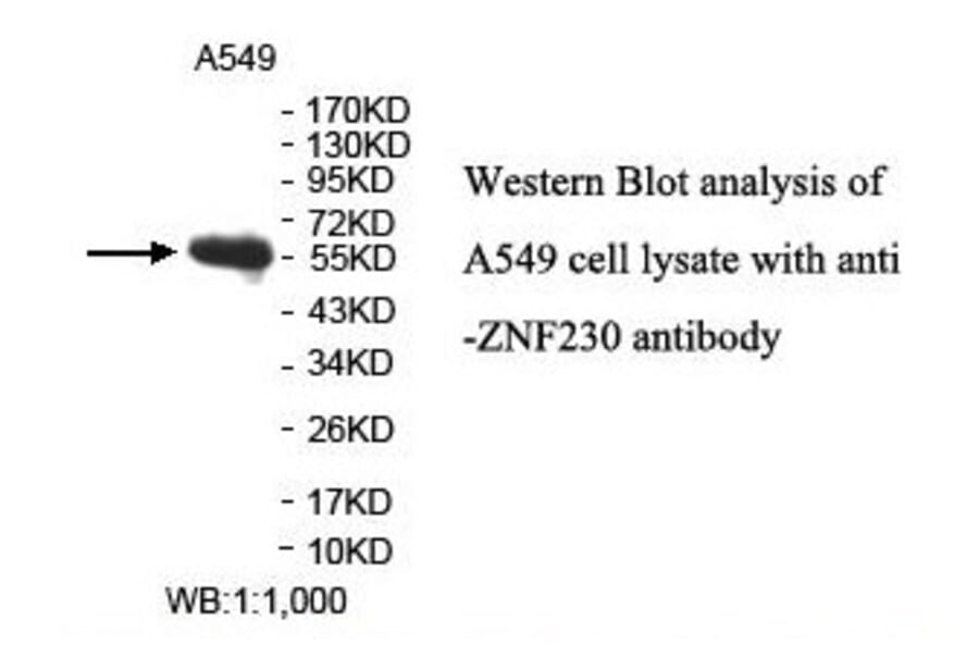 ZNF230 Antibody from Signalway Antibody (39890) - Antibodies.com