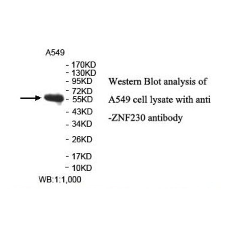 ZNF230 Antibody from Signalway Antibody (39890) - Antibodies.com