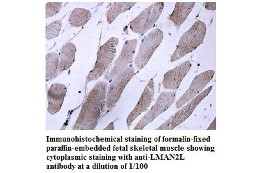 LMAN2L Antibody from Signalway Antibody (39894) - Antibodies.com