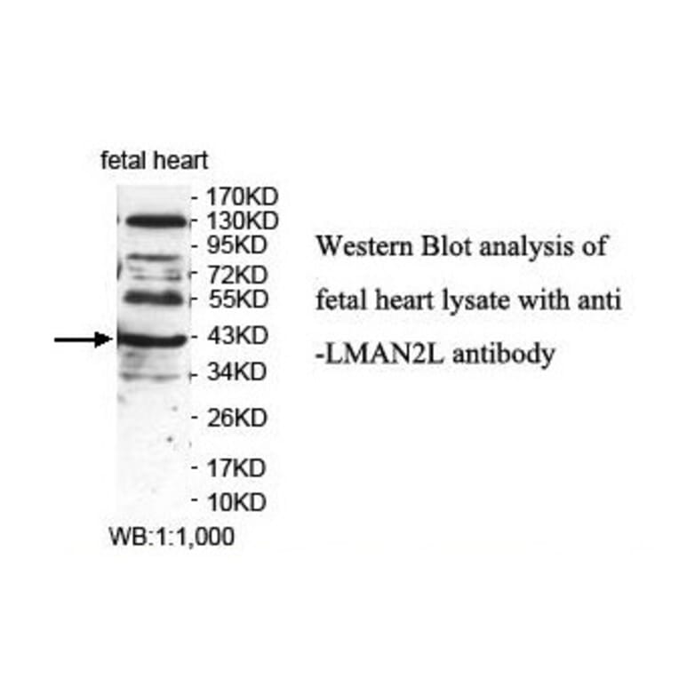 LMAN2L Antibody from Signalway Antibody (39894) - Antibodies.com