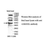 LMAN2L Antibody from Signalway Antibody (39894) - Antibodies.com