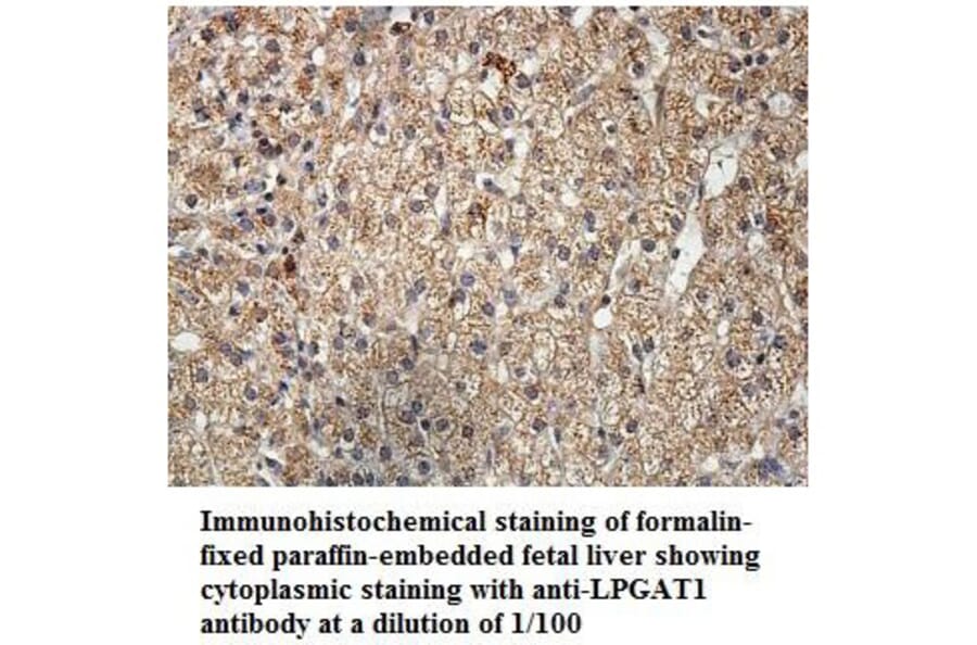 LPGAT1 Antibody from Signalway Antibody (39900) - Antibodies.com