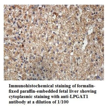 LPGAT1 Antibody from Signalway Antibody (39900) - Antibodies.com