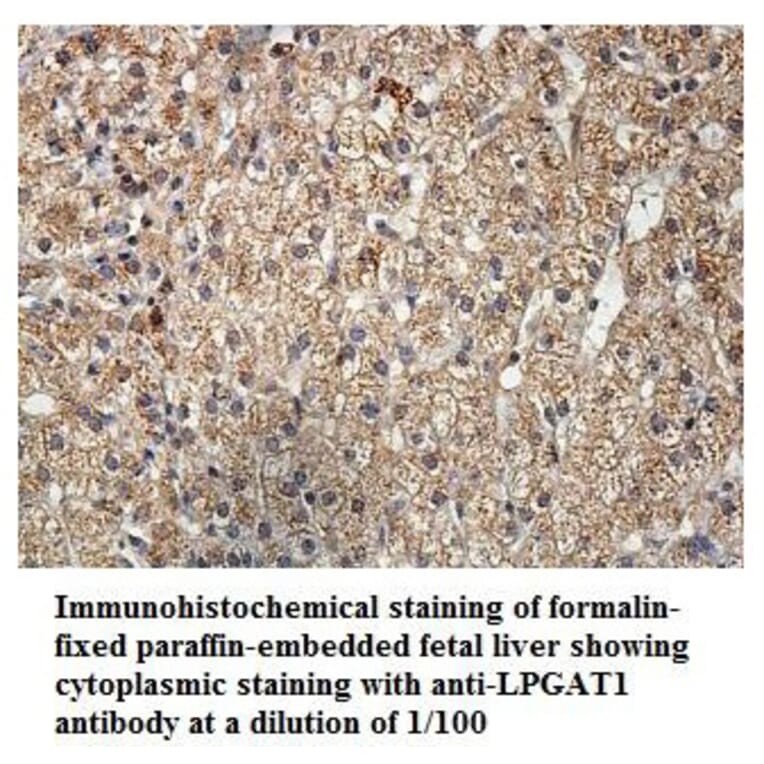 LPGAT1 Antibody from Signalway Antibody (39900) - Antibodies.com