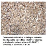 LPGAT1 Antibody from Signalway Antibody (39900) - Antibodies.com