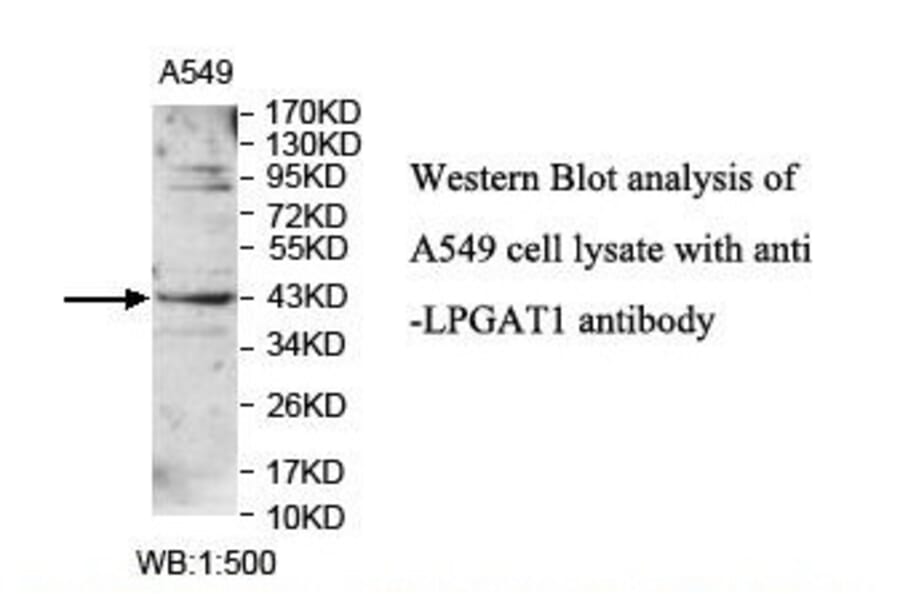 LPGAT1 Antibody from Signalway Antibody (39900) - Antibodies.com