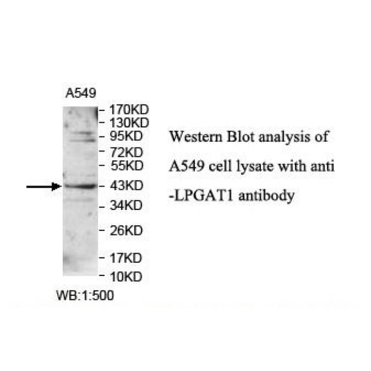 LPGAT1 Antibody from Signalway Antibody (39900) - Antibodies.com
