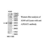 LPGAT1 Antibody from Signalway Antibody (39900) - Antibodies.com