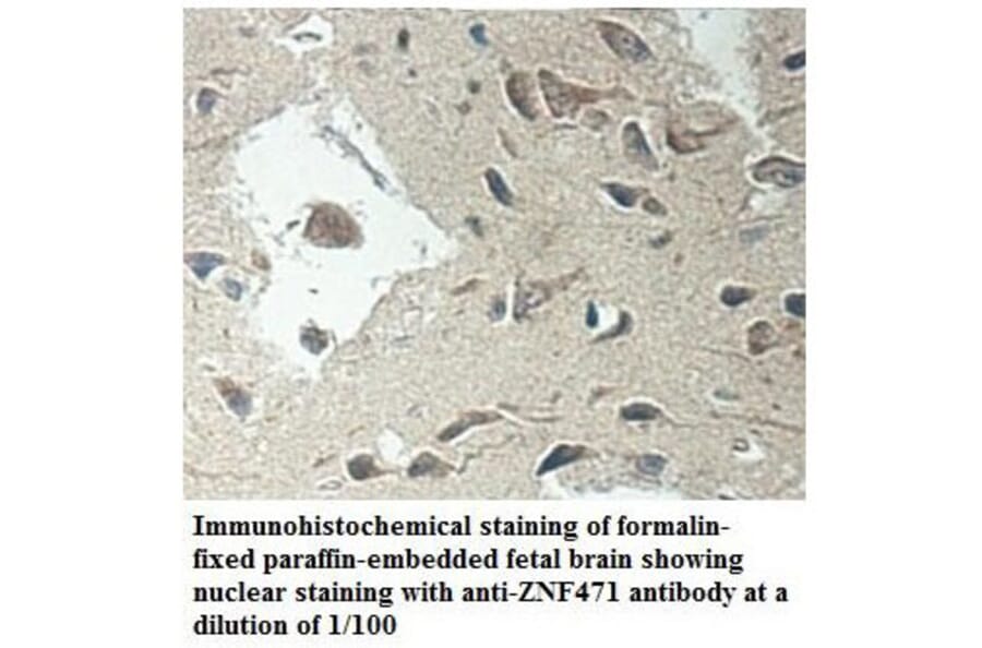 ZNF471 Antibody from Signalway Antibody (39901) - Antibodies.com