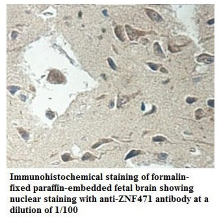 ZNF471 Antibody from Signalway Antibody (39901) - Antibodies.com